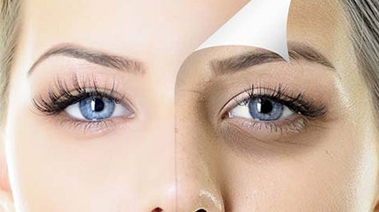 பெண்களாக இருந்தாலும் சரி, ஆண்களாக இருந்தாலும் ஒரே இரவில் கருவளையம் உடனே நீங்க டிப்ஸ்..!