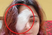 நடிகை குஷ்பு திடீர் அறுவை சிகிச்சை : கடும் அதிர்ச்சியில் பதறி போன ரசிகர்கள்…. தீயாய் பரவும் புகைப்படங்கள்!!