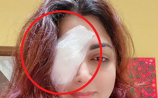 நடிகை குஷ்பு திடீர் அறுவை சிகிச்சை : கடும் அதிர்ச்சியில் பதறி போன ரசிகர்கள்…. தீயாய் பரவும் புகைப்படங்கள்!!