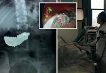 5 வயது சிறுமியின் வயிற்றை ஸ்கேன் செய்த மருத்துவர்களுக்கு காத்திருந்த அதிர்ச்சி! என்ன இருந்தது தெரியுமா?