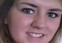 திடீரென உடல் முழுவதும் மஞ்சள் நிறமாக மாறிய இளம்பெண்… அதிர்ச்சியடைந்த மருத்துவர்கள்…!