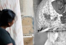 வெளிநாட்டில் இலங்கை பெண் அனுபவித்த வந்த சித்ரவதை! உடலில் தீக்காயங்கள்: முதலாளி வெறிச் செயல்!!