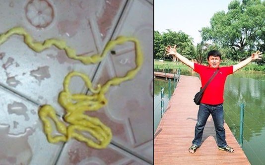 வயிற்று வ லியால் அவதியுற்ற நபர் : கழிப்பறையில் கண்ட திகில் காட்சி!!