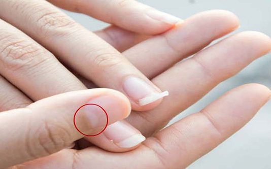 உங்களது கைவிரல் நகத்தில் பிறை போன்ற தோற்றம் இருக்கின்றதா? அப்போ கட்டாயம் இதைப் படிங்க..!!