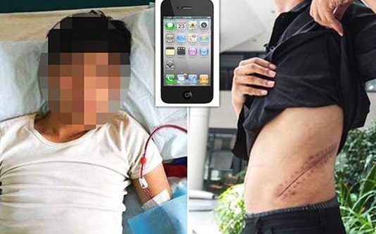 ஐ போ ன் வா ங் க வே ண் டு ம் எ ன் ற ஆ சை யா ல் கி ட் னி யை வி ற் ற இ ளை ஞ ர்.. உ யி ரு க் கு போ ரா டு ம் அ வ ல ம்… பு கைப்படம் உ ள்ளே !!