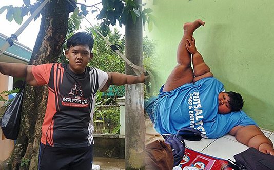 உலகிலேயே அதிக பருமனான சிறுவன்: இப்போது எப்படி இருக்கிறான் பாருங்கள்…!