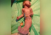 மீன் போன்று பிறந்த கு ழ ந்தை! 2 மணிநேரத்தில் உ.யி.ரிழந்த ப.ரி.தாபம்!!