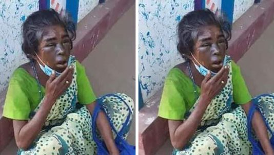 வேலை கேட்டு வந்த பெண்ணின் முகத்தில் சுடுதண்ணி ஊற்றிய பாதகி!!