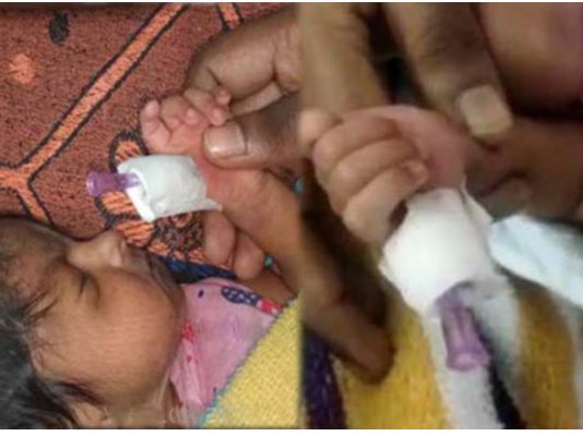 செவிலியரின் அலட்சியம்… கு.ழ.ந்.தையின் கட்டைவிரல் வெ.ட்.ட.ப்ப.ட்ட கொ.டு.மை!! நடந்தது என்ன?
