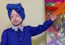 80 வயது தோற்றம்… அரியவகை நோய்: 10 வயதில் ப.ரி.தாப ம.ர.ணம்!!