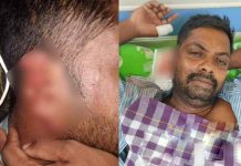 தொழிலாளியின் காதை க.டி.த்.து து.ண்.டா.க்கிய கொ.டூ.ரம்!! அ.ர.ங்கேறிய சோ.க ச.ம்.பவம்!!
