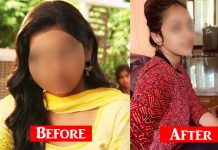 இந்த நோயால் பாதித்த இளம் நடிகை : 5 வருடங்களுக்கு பிறகு இப்படியொரு தோற்றமா? அதிர்ச்சியில் ரசிகர்கள்!!