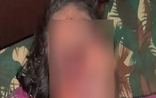 காதலியின் மூக்கை கோடாரியால் அறுத்த காதலன் : அதிர்ச்சிக் காரணம்!!