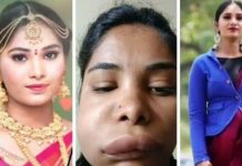 மயக்க ஊசிக்கு பதில் ஆசிட்டை செலுத்திய மருத்துவர் : பிரபல நடிகையின் கோர தோற்றத்துக்கு இதுதான் காரணமா?