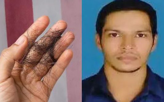 முடி கொட்டியதால் மனமுடைந்த இளைஞன் : திடீரென எடுத்த விபரீத முடிவு!!