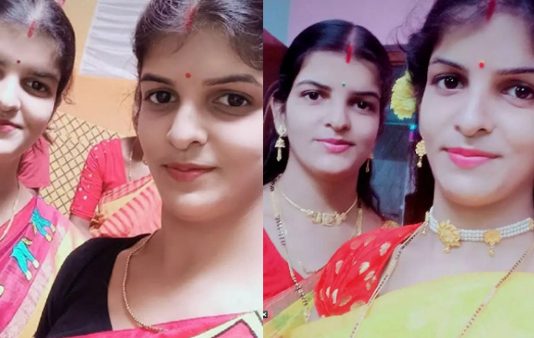 20 வருடங்களுக்கு முன்பு நாங்கள் ஒட்டி பிறந்த இரட்டையர்கள் : தற்போதைய நிலவரம் என்ன? நெகிழும் இரட்டை சகோதரிகள்!!