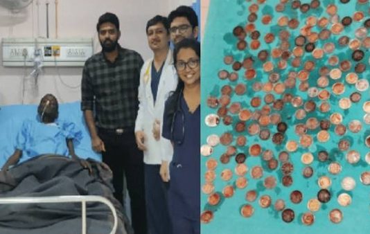 பிச்சைக்காரர் வயிற்றில் இருந்த 187 நாணயங்கள்…. தினமும் சாப்பிட்டு மகிழ்ந்ததாக அதிர்ச்சி தகவல்!!