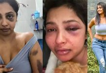 அடித்து துவைத்தெடுத்த காதலன்… ஆதாரத்தை வெளியிட்டு நடிகை கண்ணீர் புகார்!!