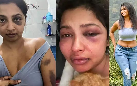 அடித்து துவைத்தெடுத்த காதலன்… ஆதாரத்தை வெளியிட்டு நடிகை கண்ணீர் புகார்!!