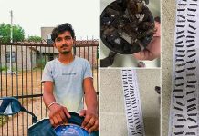ரத்த வாந்தி எடுத்த இளைஞன்… வயிற்றில் இருந்த 56 பிளேடுகள் : அதிர்ந்துபோன மருத்துவர்கள்!!