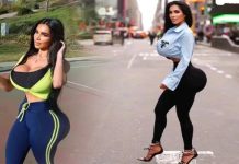 பிளாஸ்டிக் அறுவை சிகிச்சையால் பிரபல மாடல் அழகிக்கு நேர்ந்த விபரீதம்!!