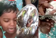 விபரீதமான விளையாட்டு.. இட்லி தட்டு ஓட்டைக்குள் சிக்கிய சிறுமியின் விரல் : பெற்றோர்களே எச்சரிக்கை!!
