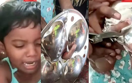 விபரீதமான விளையாட்டு.. இட்லி தட்டு ஓட்டைக்குள் சிக்கிய சிறுமியின் விரல் : பெற்றோர்களே எச்சரிக்கை!!