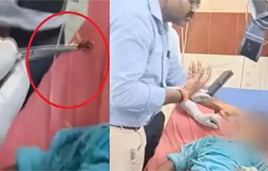 சிறுவனின் காதுக்குள் கூடு கட்டிய தேனீ…. கதறித் துடித்த பெற்றோர் : பின்னர் நடந்த சம்பவம்!!