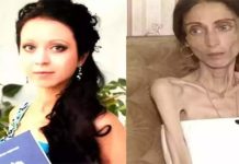 கணவருக்காக எலும்பும் தோலுமாக மாறிய இளம்பெண்.. அதிர்ச்சி தகவல்!!