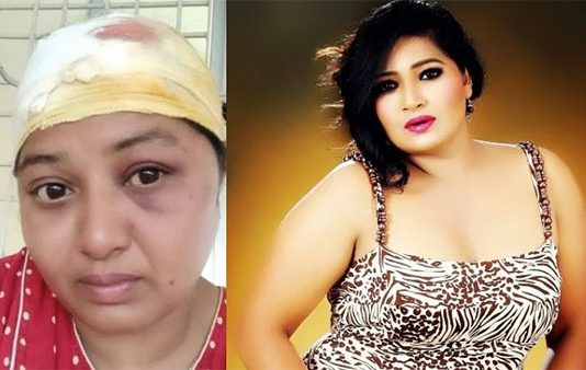 பிரபல நடிகையின் மண்டையை உடைத்த பெண்: போலிசார் தீவிர விசாரணை : பின்னணி என்ன?