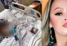 மீன் சாப்பிட்டதால் கை, கால்களை இழந்து உயிருக்கு போராடும் பெண்!!