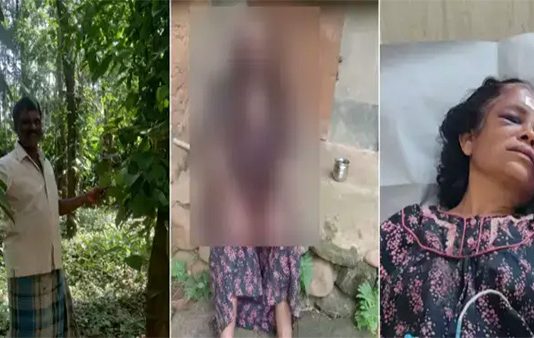 மனைவியின் கண்கள், கன்னங்களை கடித்து துப்பிய கணவனின் கொடூர செயல்!!