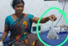 கடித்த பாம்புடன் மருத்துவமனைக்கு வந்த இளம்பெண்.. பதறிய மருத்துவர்கள்!!